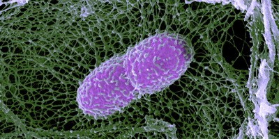 Ступінь стійкості до антибіотиків оцінили в Європі